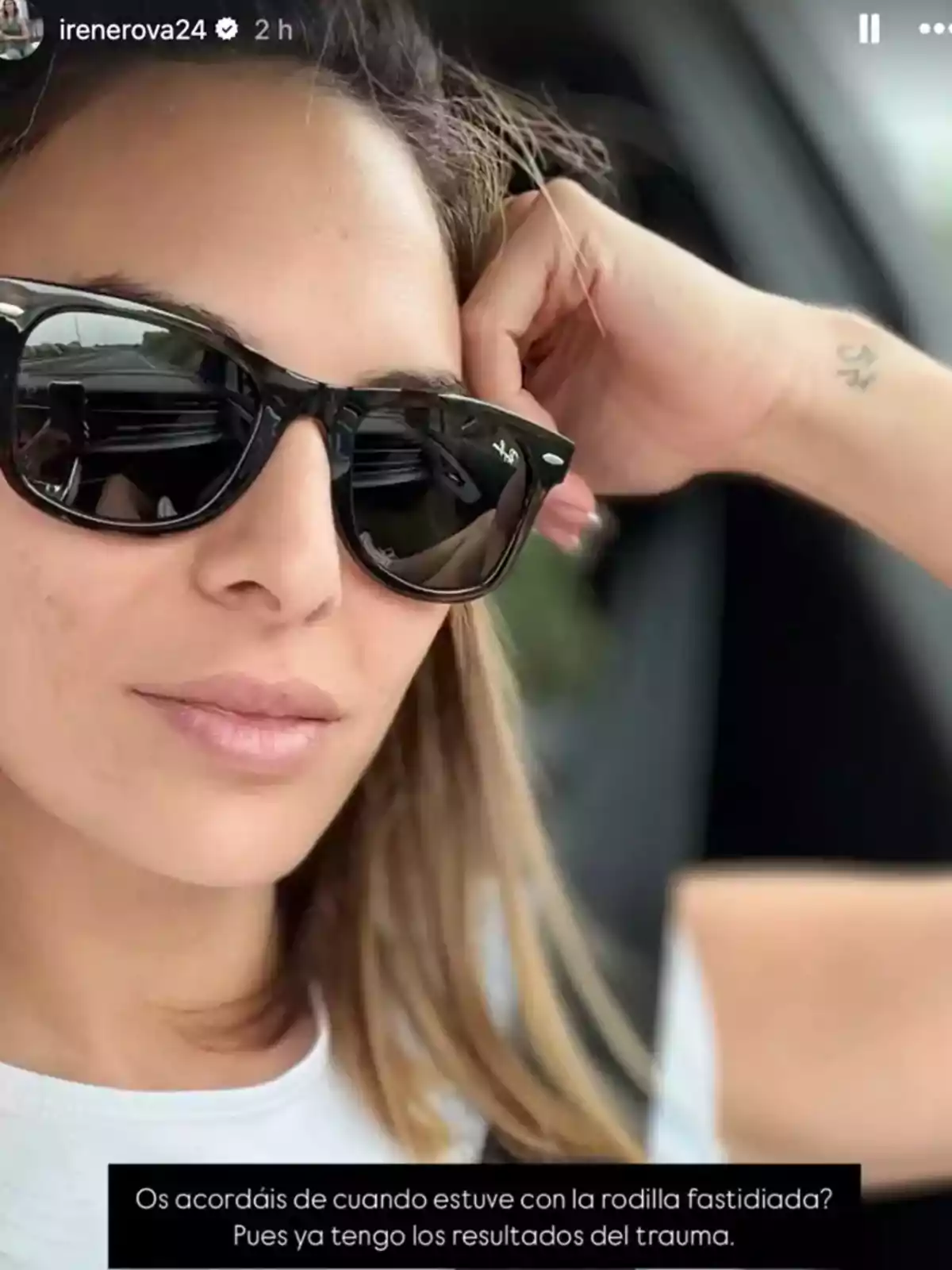 Irene Rosales con gafas de sol negras y camiseta blanca sentada en un coche apoyando la cabeza en su mano con un pequeño tatuaje visible en la muñeca Irene Rosales con gafas de sol negras y camiseta blanca sentada en un coche apoyando la cabeza en su mano con un pequeño tatuaje visible en la muñeca