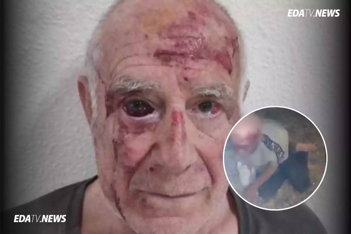 Hombre mayor con heridas visibles en el rostro y un ojo morado, acompañado de un recuadro donde se muestra a una persona en el suelo