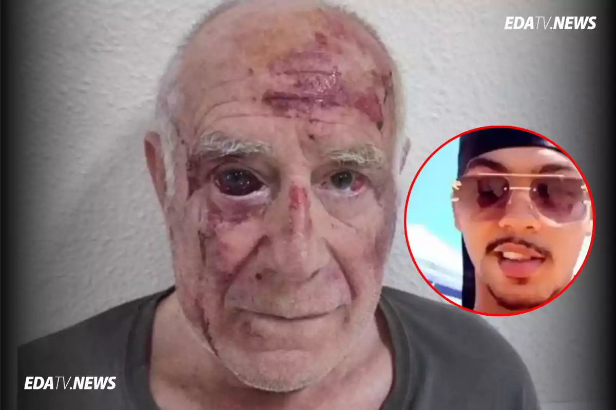 Hombre mayor con heridas visibles en el rostro y un círculo con la imagen de un joven con gafas de sol en la esquina derecha