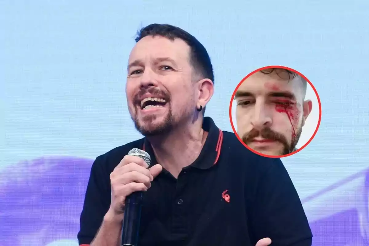 Hombre con barba y micrófono hablando en público con un recuadro que muestra a otra persona con una herida sangrante en el rostro