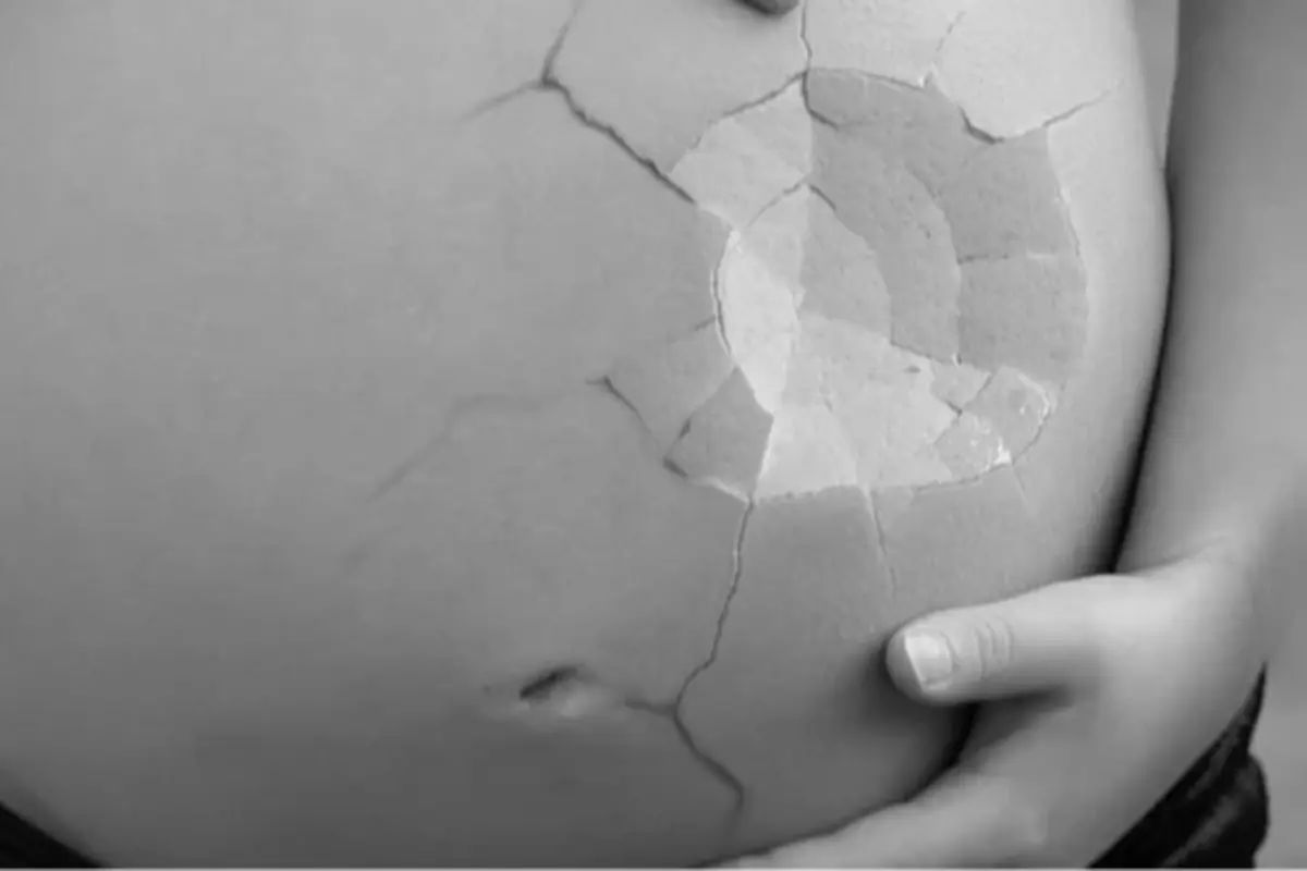 Vientre de mujer embarazada en blanco y negro con efecto de piel agrietada y manos sosteniéndolo