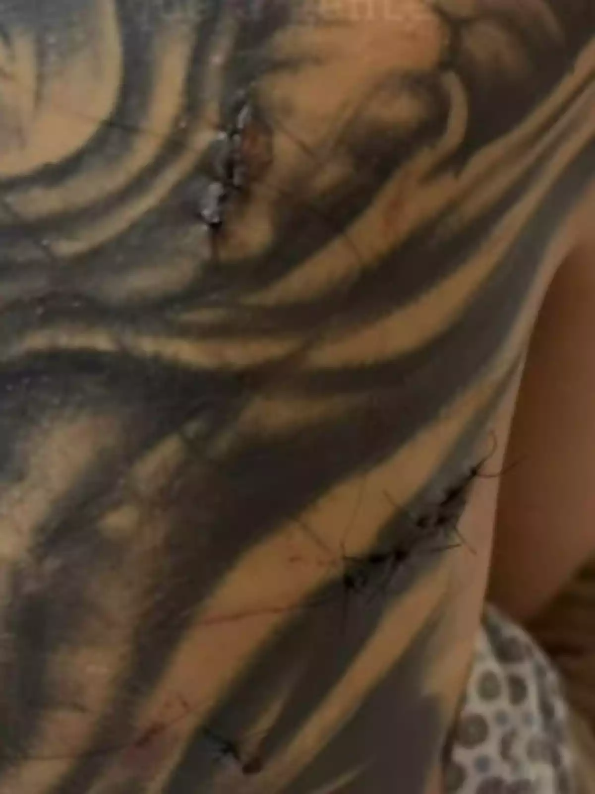 Un tatuaje en la piel con varias suturas visibles. Un tatuaje en la piel con varias suturas visibles.