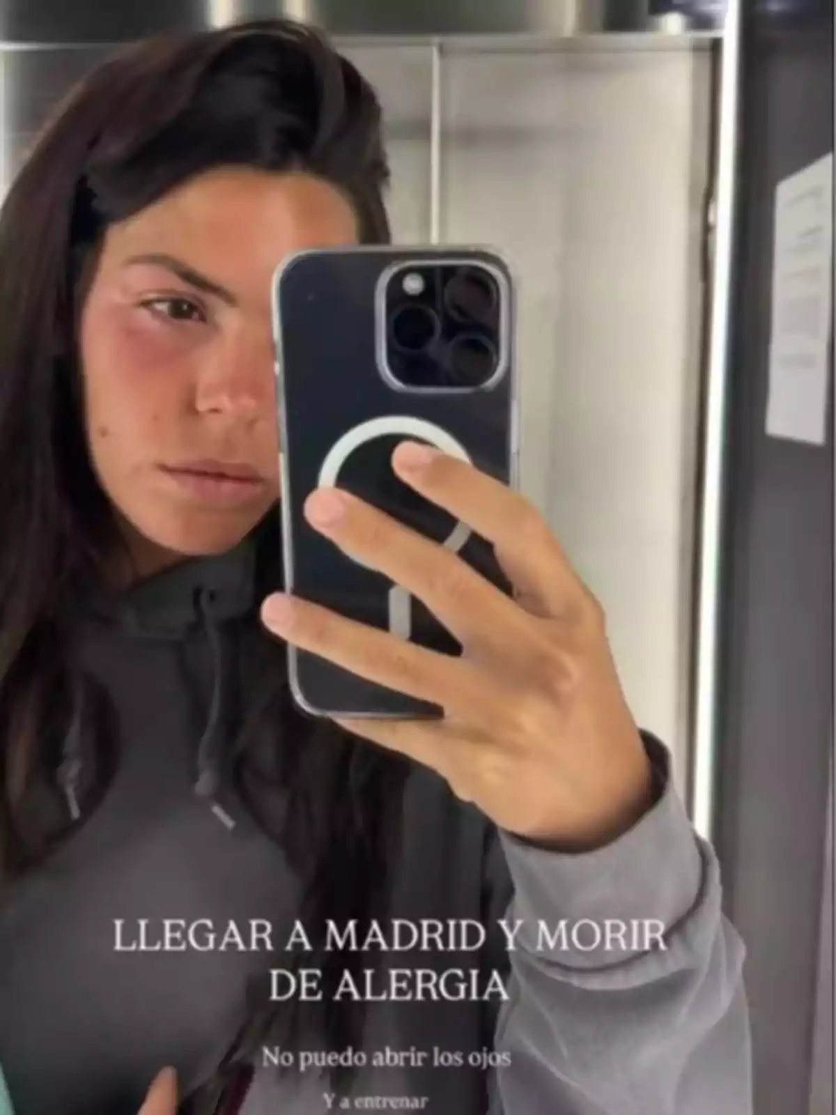 Laura Matamoros con sudadera gris tomándose una selfie en un espejo, con el ojo izquierdo visiblemente hinchado y enrojecido, mostrando síntomas de alergia y un texto sobre la imagen que menciona su malestar al llegar a Madrid. Laura Matamoros con sudadera gris tomándose una selfie en un espejo, con el ojo izquierdo visiblemente hinchado y enrojecido, mostrando síntomas de alergia y un texto sobre la imagen que menciona su malestar al llegar a Madrid.