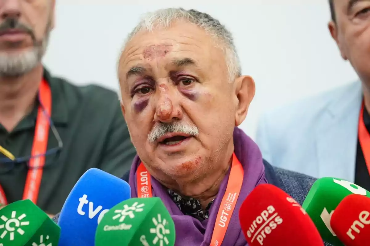 Hombre mayor con moretones en el rostro hablando ante varios micrófonos de diferentes medios de comunicación