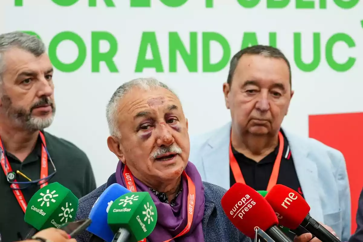 Tres hombres mayores en una rueda de prensa, el del centro tiene moretones visibles en el rostro y está rodeado de micrófonos de diferentes medios de comunicación Tres hombres mayores en una rueda de prensa, el del centro tiene moretones visibles en el rostro y está rodeado de micrófonos de diferentes medios de comunicación