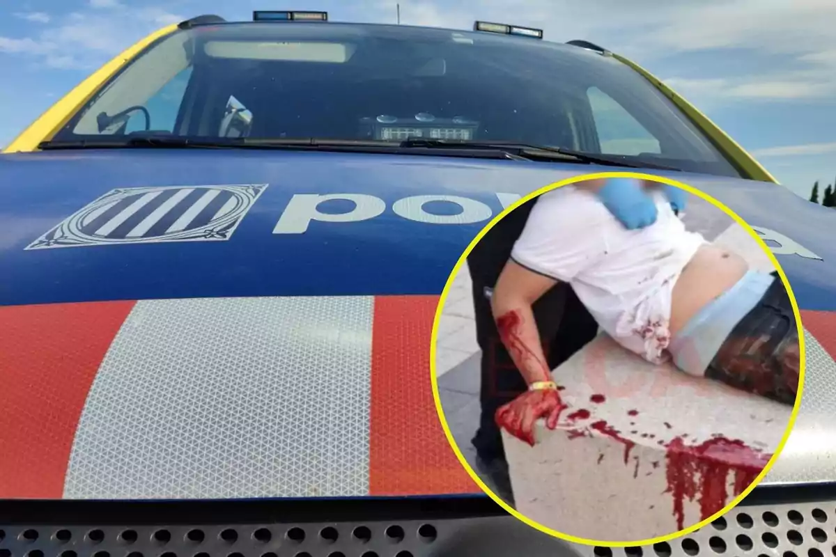 Un coche de policía con un emblema en el capó y una imagen insertada de una persona herida con sangre.