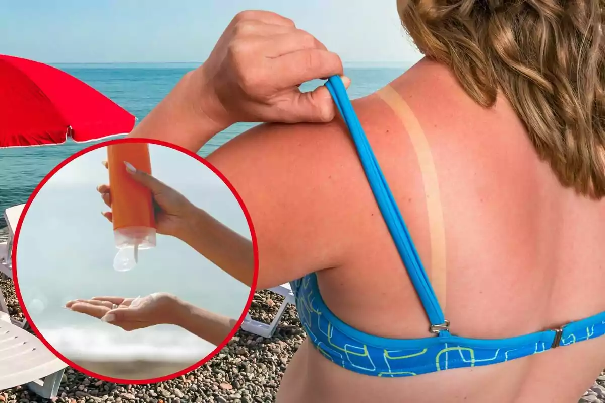 Una mujer enseña la quemadura del sol en la playa, y en el círculo, un bote de protección solar Una mujer enseña la quemadura del sol en la playa, y en el círculo, un bote de protección solar