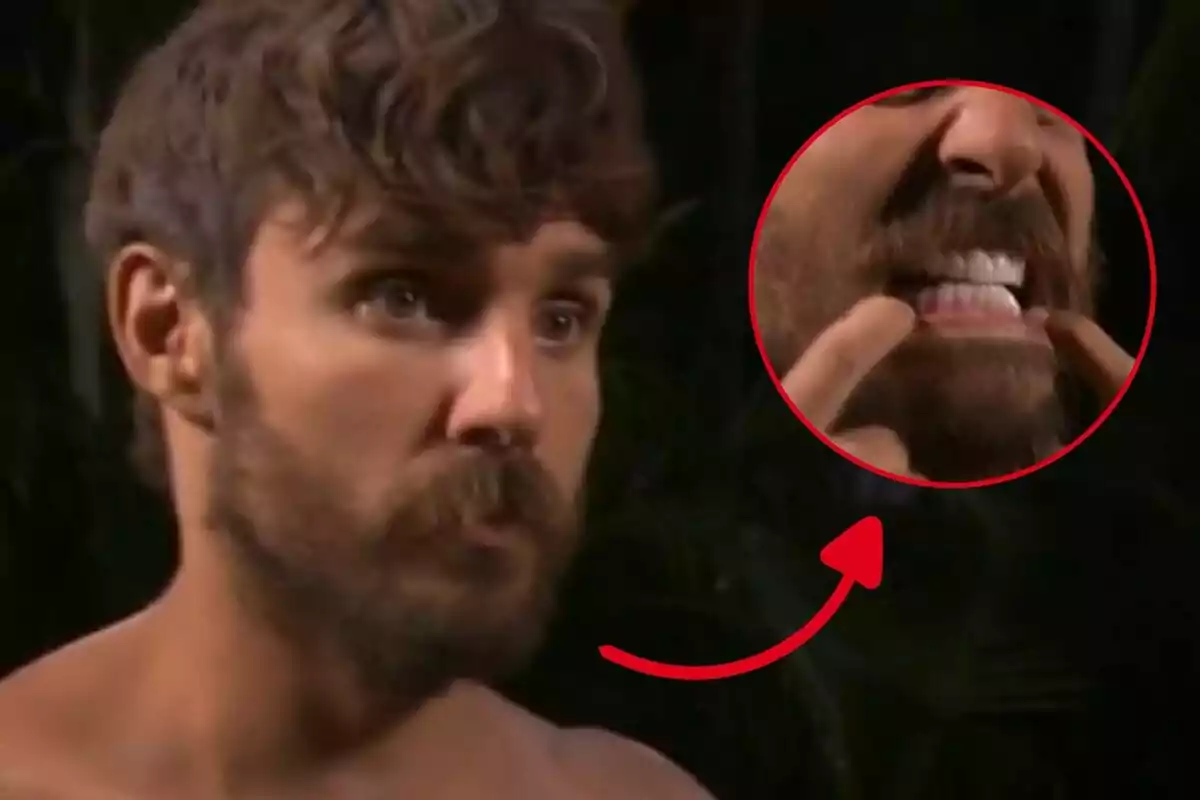 Manuel González está mostrando sus dientes en un círculo ampliado con una flecha roja que señala hacia su boca.