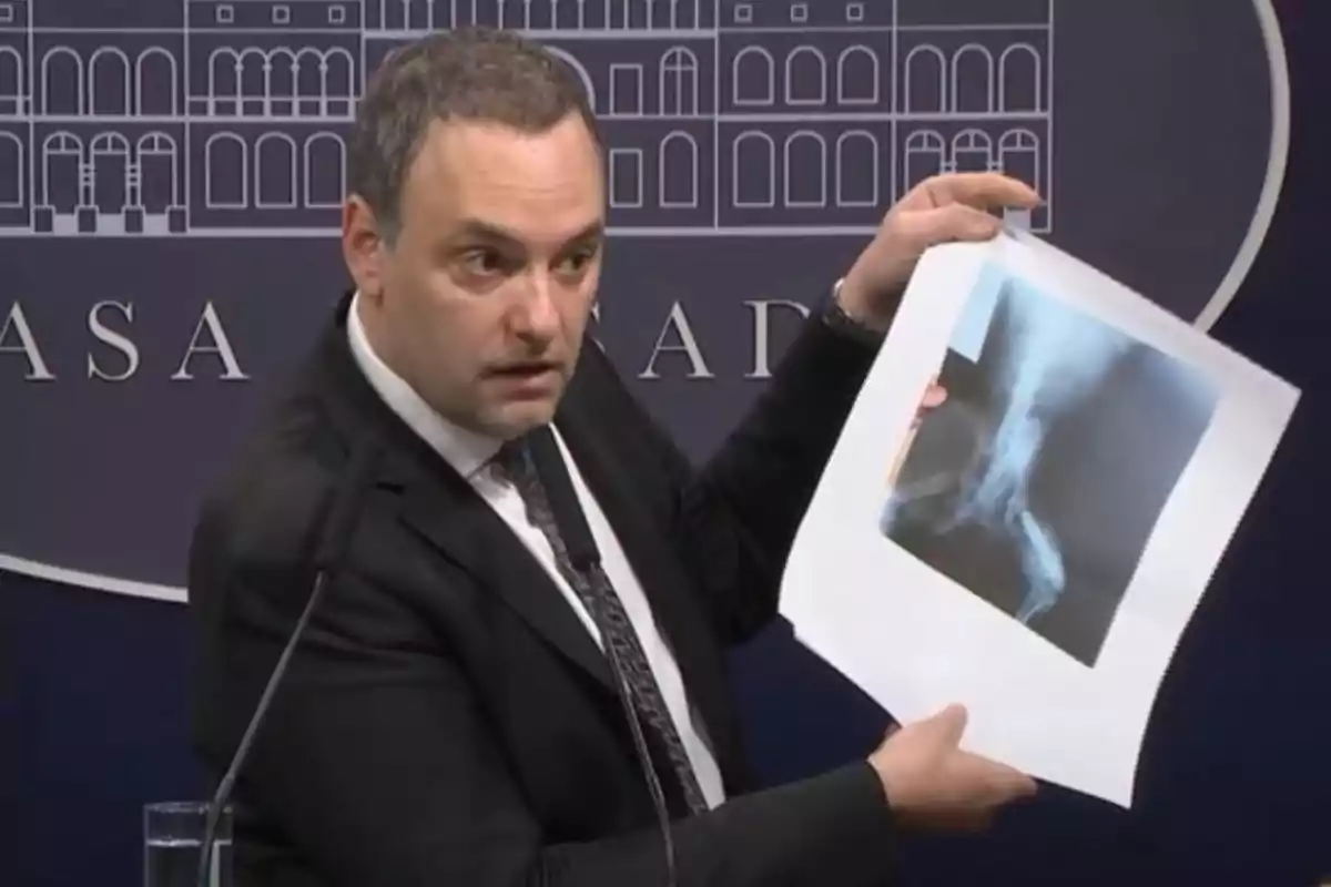 Hombre en traje sosteniendo una radiografía durante una conferencia de prensa.